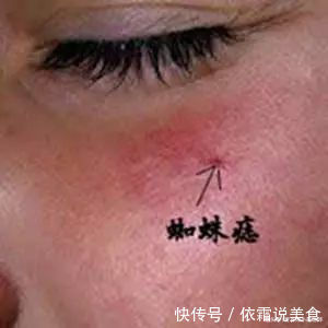 娇妻|45岁男子确诊肝癌,1个多月后离世,家属痛哭与妻子脱不了干系