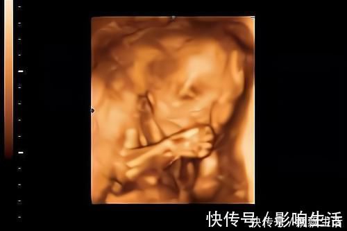 胎动|胎儿性格隔着肚皮能看出来吗？孕期欢脱的胎儿，出生后也多调皮