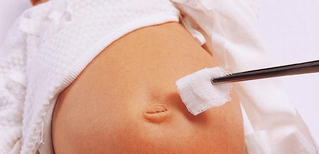 膀胱经|儿科医生经常抚摸宝宝身上这4个部位，既增强智力，又利于健康