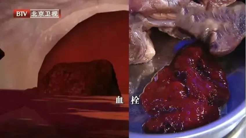 维生素e|天然血管清道夫,老中医早餐吃它50年,血管干净,心脏如小年轻!