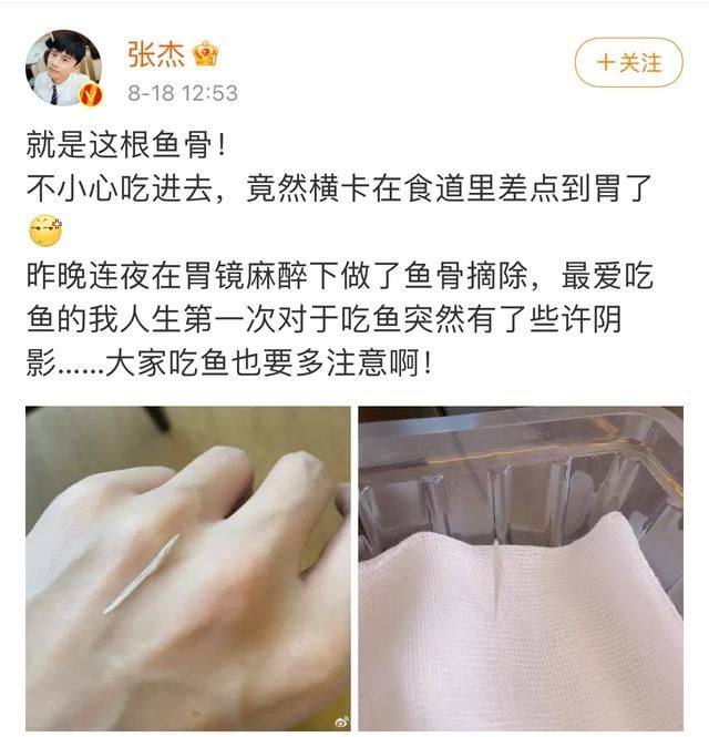 鱼骨|张杰吃鱼鱼骨卡在食道里，网友：你吃的什么鱼，谢娜在和你抢吗？