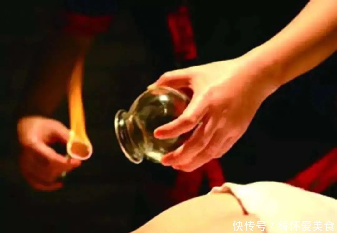 湿气|拔火罐到底吸出来是湿气，还是毒素？答案或和你想的不同