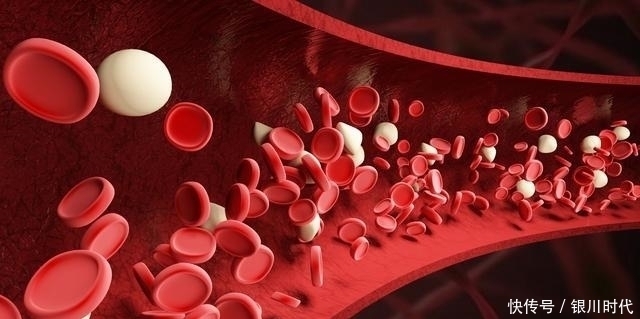 胆固醇|一天一个苹果能清血管？医生：要想真正疏通血管，5件事最好别做