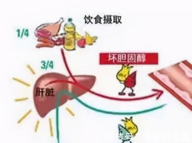 指标|腿是第二个心脏!胆固醇有没有超标不要查血脂,腿上就有信号