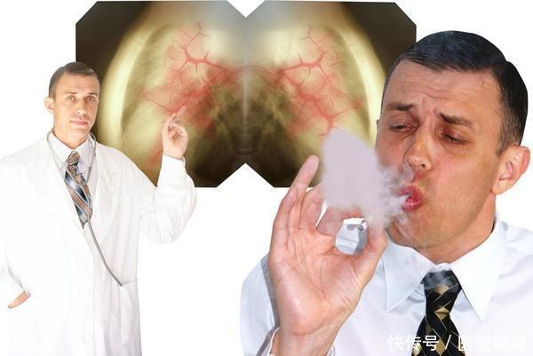 趋势|癌症发病率呈现年轻化趋势？医生：这5个行为，少碰才好