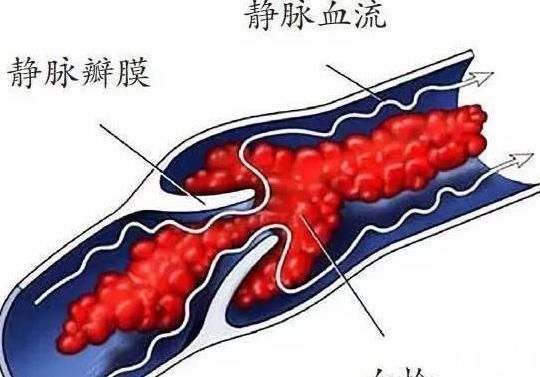 食物世界|被称为食物世界的'阿司匹林'，如果你经常吃一点，血栓就会走了！