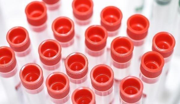 血液|血型与疾病有关联?易“长寿”的血型是它,你是哪种血型呢?