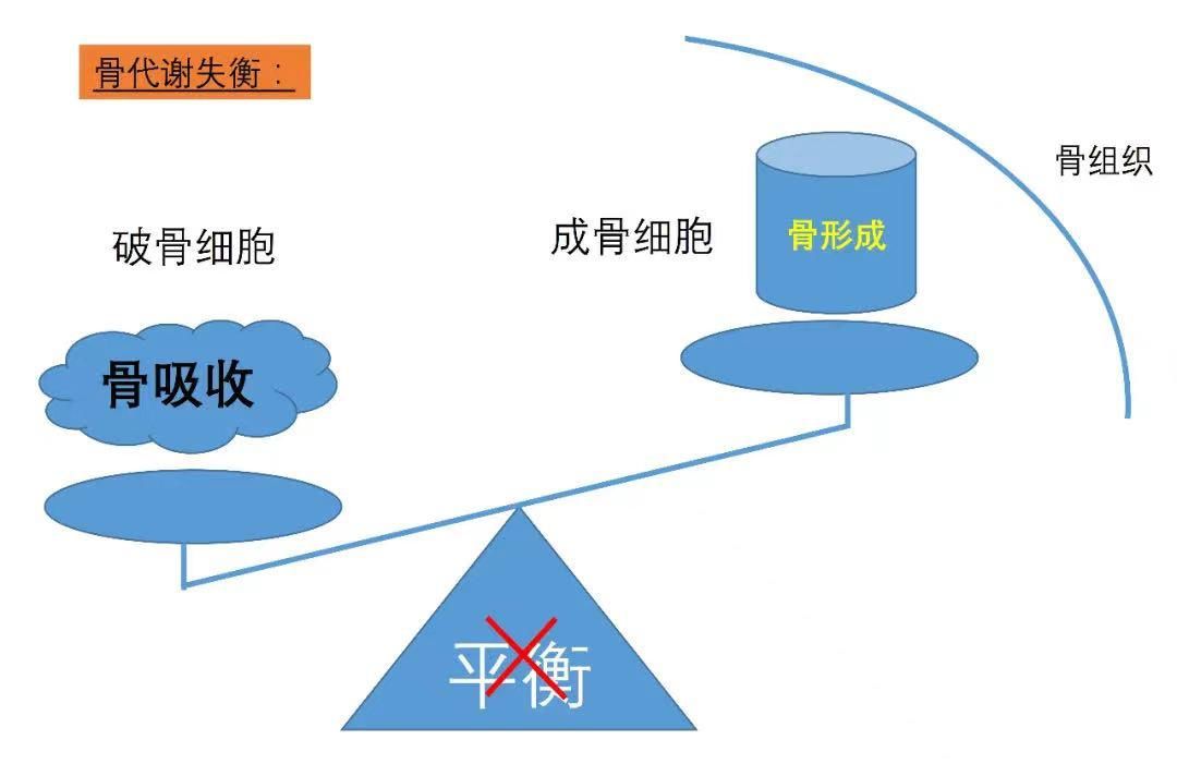 失眠|经常失眠的人，你的“骨折”风险比一般人高