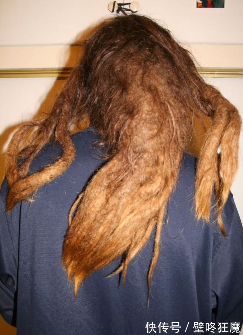 头发|女子10年不洗头发,丈夫忍无可忍,跟她离婚