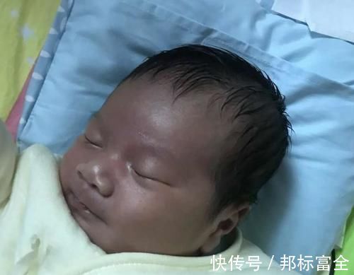 口腔|“黑脸宝宝”走红,长开后变成小帅哥,网友:还好父母忍住没扔