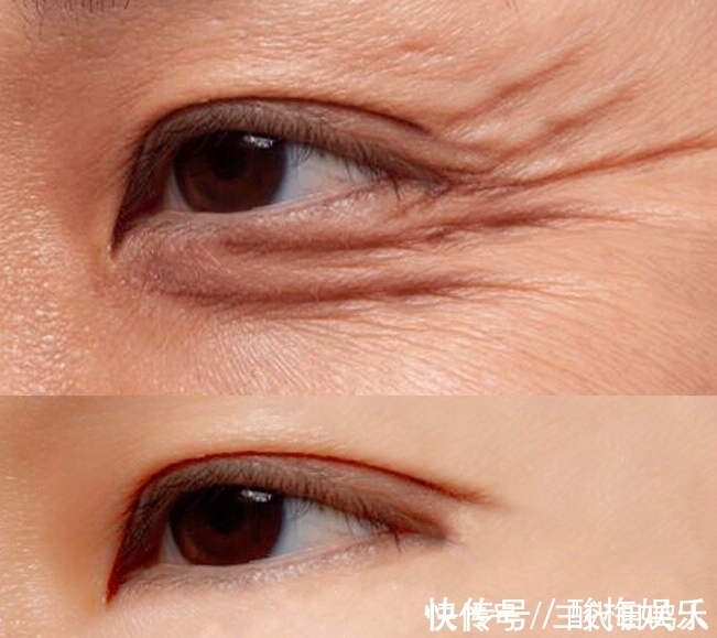 保湿|再三提醒:在药店见这“乳膏”定要买下!坚持2周,肤白貌美