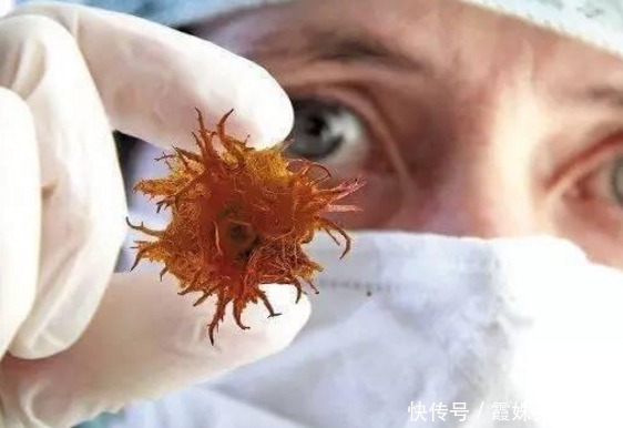 癌症晚期|癌症晚期还可以活多久？医院主任：说了3句“大实话”！