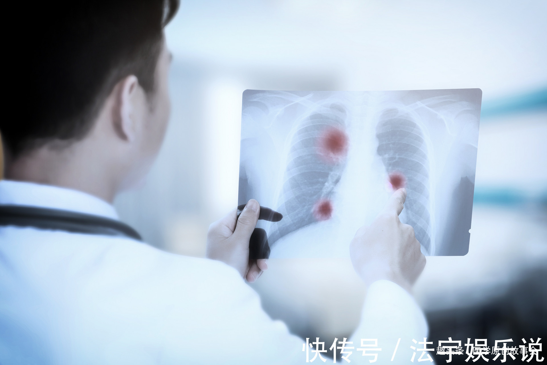 肿瘤科|肺癌根本不用治肿瘤科医生提醒，只要做好五点，可以长期生存