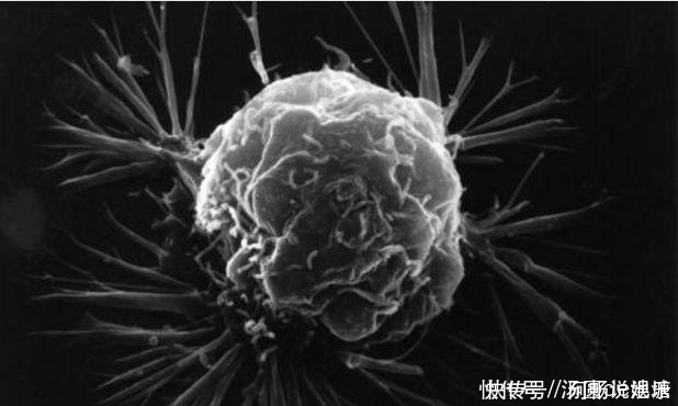 人人|这个国家无人患癌,这3种食物至关重要,人人需要知道