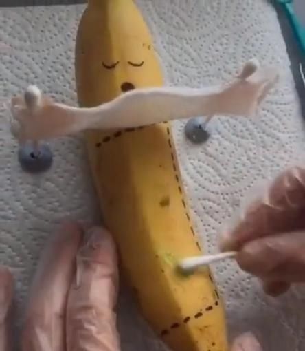 过程|剖腹产真的很轻松吗?看完“香蕉产妇”的分娩过程,或许你会改观