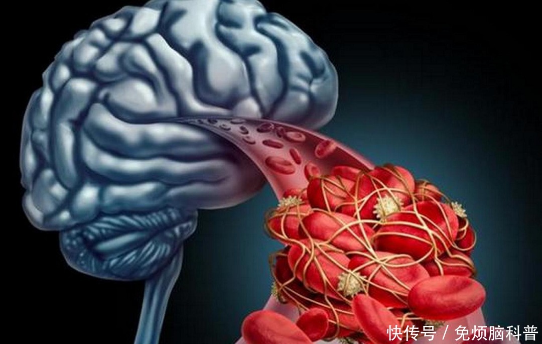 茄子|65岁大妈每天吃素,却突发脑梗离世,建议:少吃这3种菜