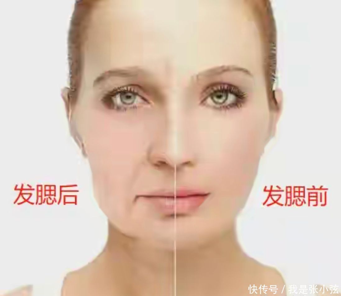 44岁万茜生图曝光生图下满脸痘印虎背熊腰法令纹抢镜显老态