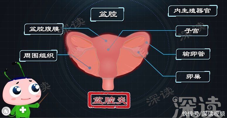 白带异常|白带异常咋回事？不孕背后真相是啥？暖心科普盆腔炎发病机制