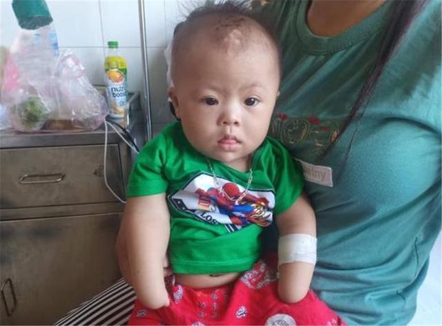 怀孕|多次产检医生都说正常,孩子出生后,孕妇哭泣医生傻眼,娃太可怜