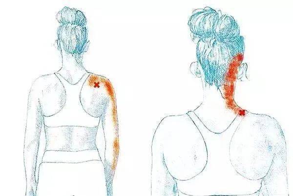 手部麻木的7种常见病因、如何鉴别及治疗