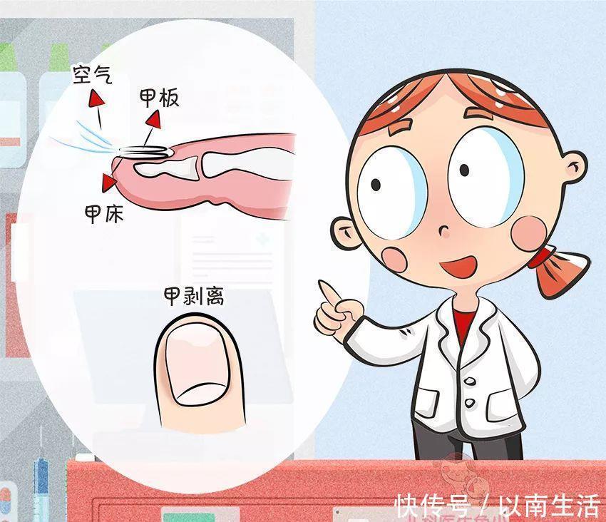 爸妈|倒刺、白斑，这还是宝宝的小指甲吗？要紧吗？宝宝指甲问题大汇总
