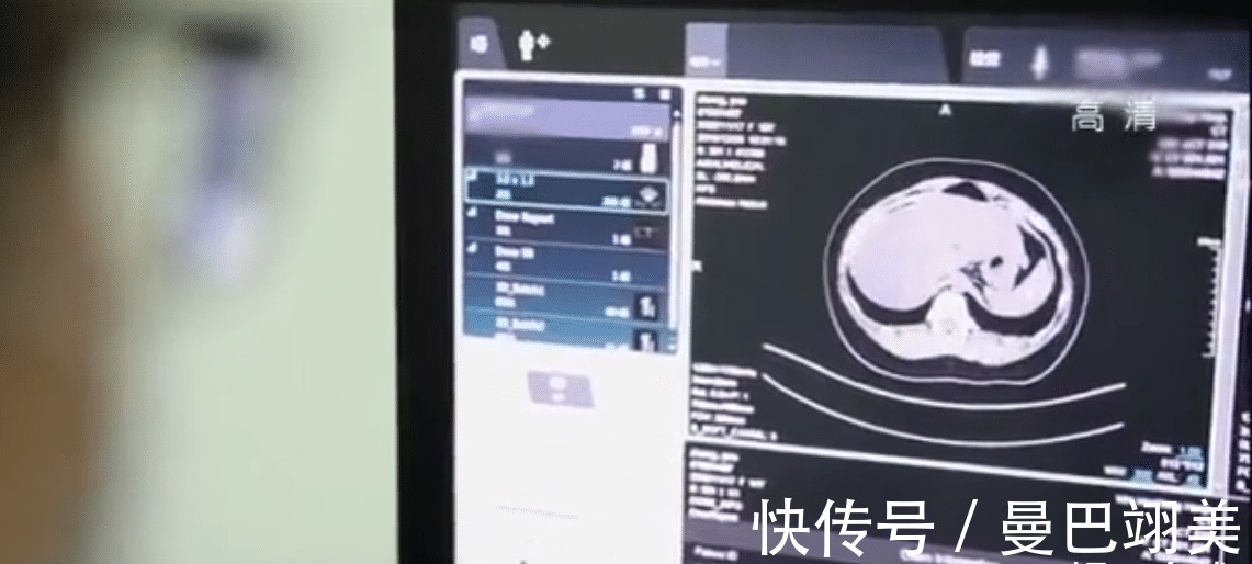 送医|17岁少女肚子疼送医,竟抽出粉色的血,医生:赶紧准备后事!