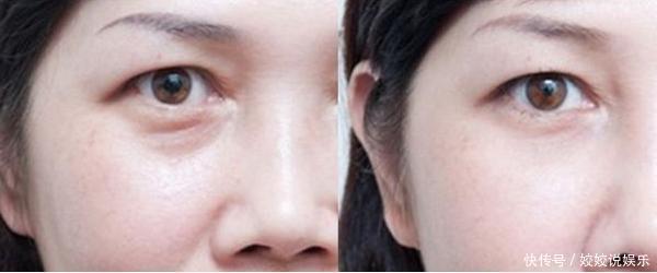 女人一旦有了眼袋皱纹,30岁像50岁!再不保养,你就真的老了