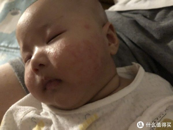 疹子|宝宝湿疹保湿霜哪家强？快来看看，避免入坑