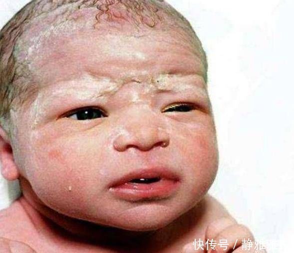 妈妈们|宝妈太爱干净了,出生15天后,她的孩子被送到了医院,医生责备宝妈无知