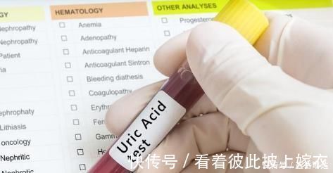 尿酸|尿酸高引起痛风,高尿酸是否需要服药呢?来看看医生怎么说