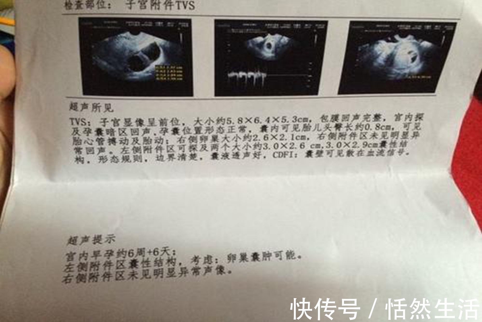 胎儿|孕期B超单上四个指标,暗示胎儿健康信号,达标孕妈可以放心了