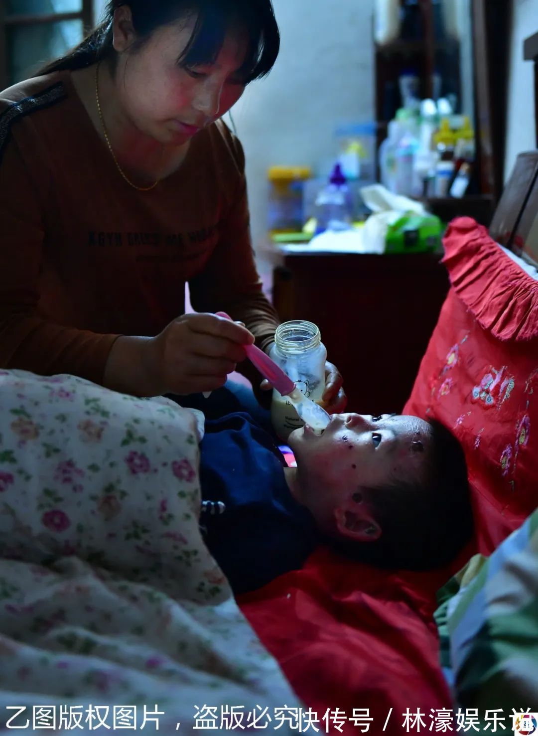 纱布|男童出生患罕见病,三年用掉纱布5000多圈,每天只能坐在床上