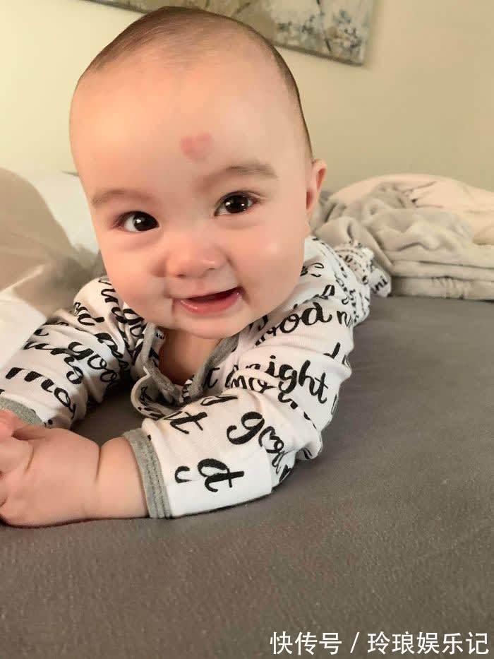 脚趾|19个“被上帝挑选过”的特殊基因人类,怎么梳都不整齐的头发