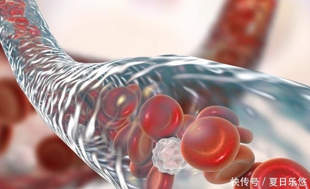 依次|得了高血脂不用慌,这些事情依次做好,血脂不敢“作乱”