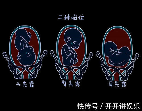 假性|怀孕28周去产检,这3个问题,就算医生不提及,孕妇也要记得问