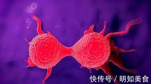 发财树发黄还烂根？水浇错了，换个浇法呼呼疯长，植株苍劲挺拔