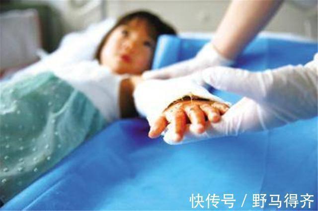 小女孩|小女孩双手伸进油锅,奶奶教科书式处理保住孩子双手,医生都称赞