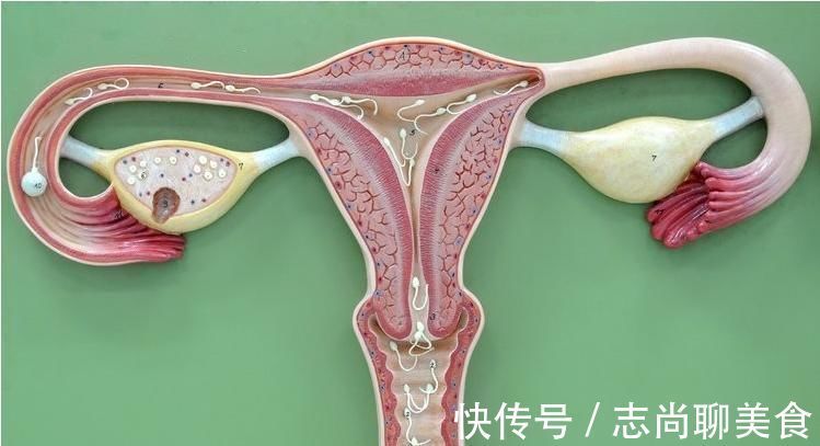 白带增多|得了子宫肌瘤的人,都会有这5个难堪,别不承认