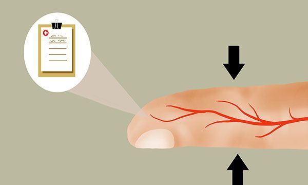 胰腺|糖尿病真的是因为糖吃太多吗?你爱吃的3样食物,或是“帮凶”
