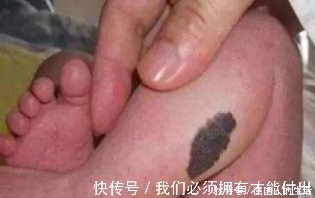 化学物质|孕妈在孕期,尽量不做4件事,避免宝宝脸上长胎记,孕妈别不在意