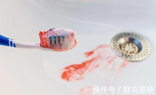 中医|脾虚不能随便补,对症健脾效果好!脾怕的5件事,大家别再做了