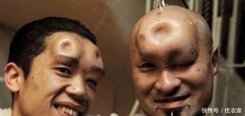 现实版的”脑子进水”，日本人流行的整形方式，我们读不懂的时尚