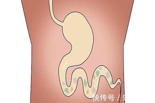 便秘|长期便秘，一般是什么原因引起的？越早解决越好