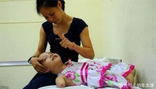 孩子|孕检发现孩子没有手脚,妈妈却坚持和医生说“生”,如今活成公主