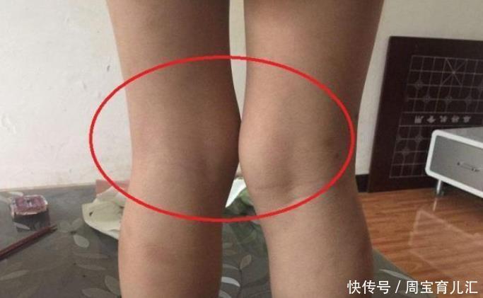 脚底|家长带孩子“泡脚”,或会耽误娃的脚部发育,现在改还来得及