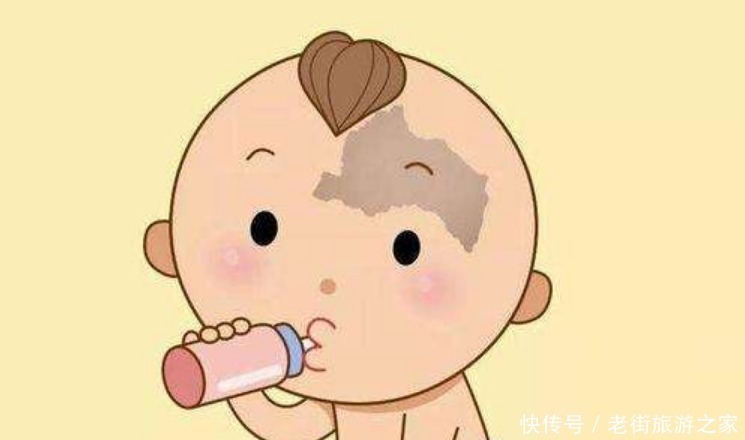 孕妈若有4个行为,胎儿脸上容易留胎记,别让宝宝长大自卑