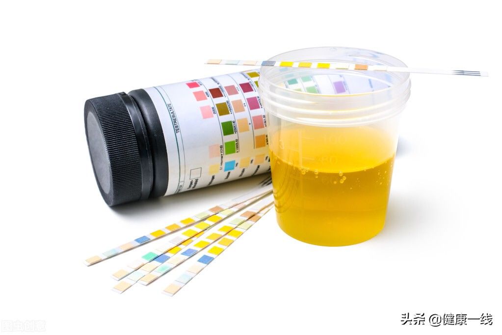 烦渴症|喝水后多久排尿才算正常？