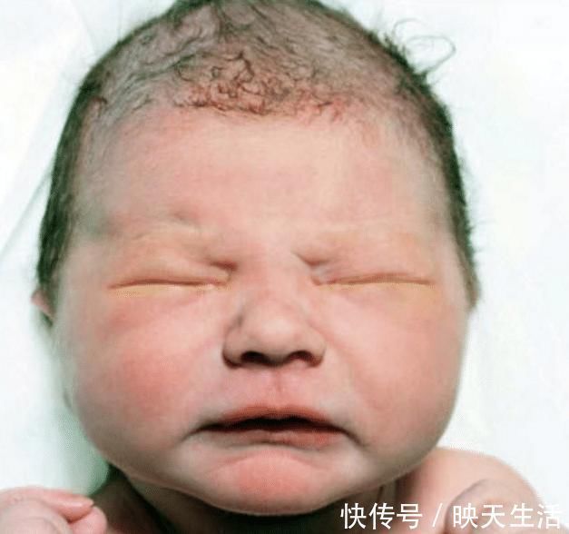 颜值|宝宝出生后,这3个地方越丑,长大后颜值越高!家长就偷着乐吧