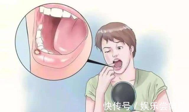 胃溃疡|养胃“冠军”公布,不是小米粥,平时敞开吃,或能增强胃动力