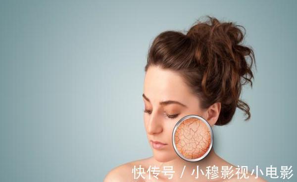 面色|肝癌总是晚期才发现其实早有4个预兆,很多人都错过了